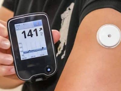 glucose monitoring system Dexcom Continuous Glucose Monitoring